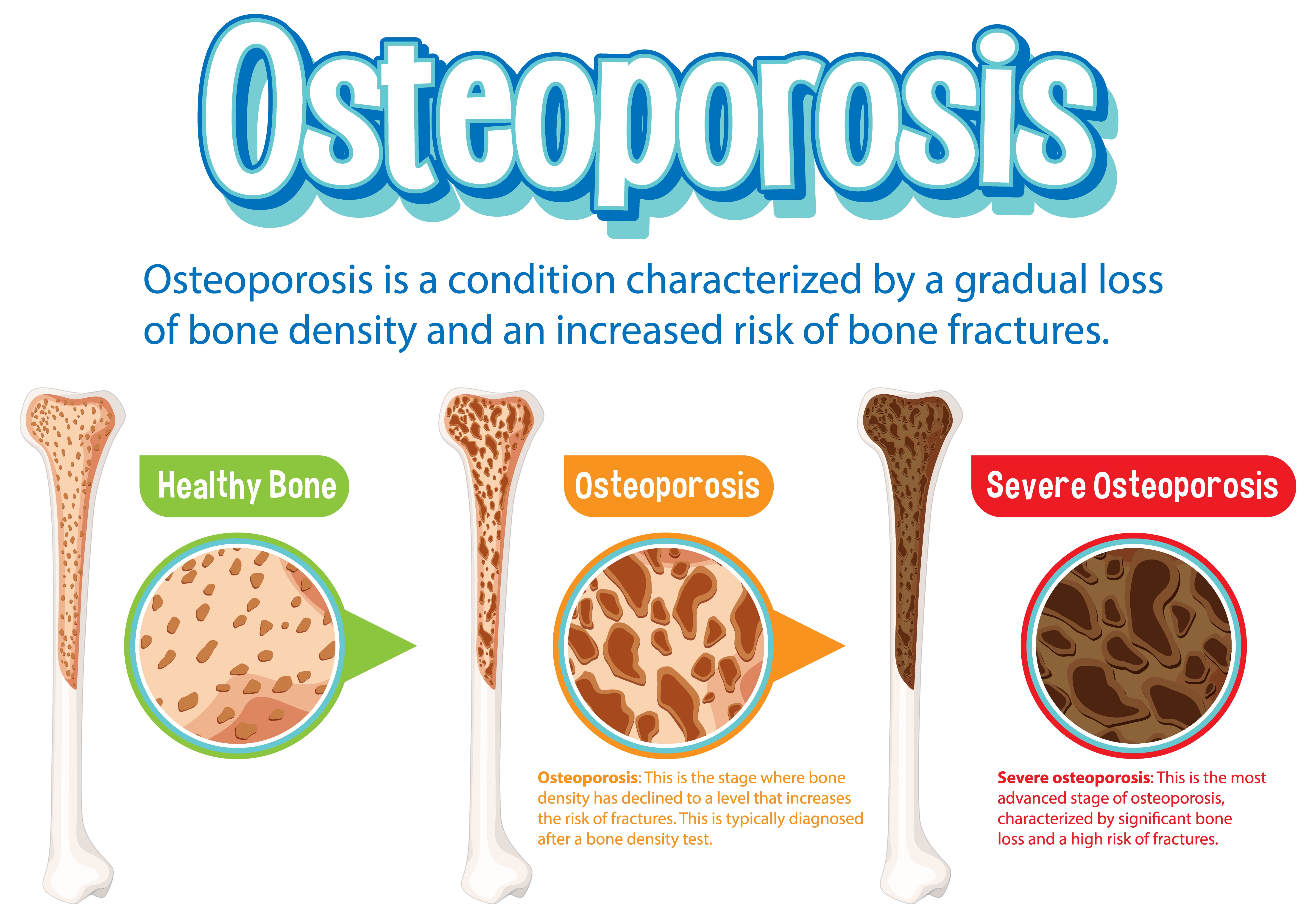 types of osteoporosis